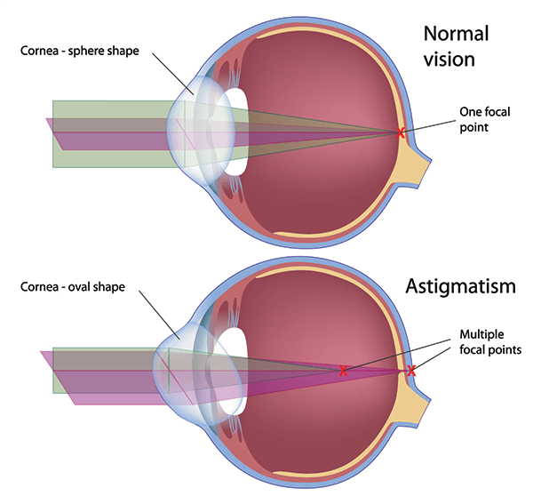 Corrective Lenses in Highbridge Park